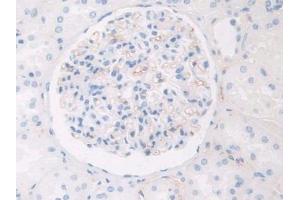 Used in DAB staining on fromalin fixed paraffin- embedded kidney tissue (HPR anticorps  (AA 30-85))