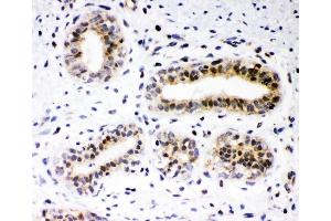 IHC analysis of RUNX2 using anti-RUNX2 antibody (ABIN3043318). (RUNX1 anticorps  (Middle Region))