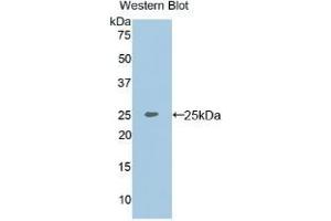 Detection of Recombinant MEPE, Rat using Polyclonal Antibody to Matrix Extracellular Phosphoglycoprotein (MEPE) (MEPE anticorps  (AA 28-224))