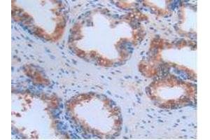 IHC-P analysis of Human Prostate Gland Tissue, with DAB staining. (CRP anticorps  (AA 17-224))