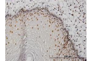 Image no. 3 for anti-Metastasis Associated 1 (MTA1) (AA 601-701) antibody (ABIN598597) (MTA1 anticorps  (AA 601-701))
