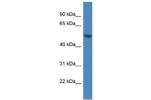 WB Suggested Anti-ARHGAP19 AntibodyTitration: 1. (ARHGAP19 anticorps  (C-Term))