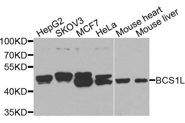 BCS1L antibody  (AA 33-240)