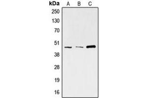 Western blot analysis of SKP2 expression in A673 (A), HeLa (B), K562 (C) whole cell lysates. (SKP2 anticorps  (C-Term))