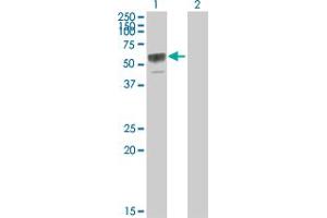 Western Blot analysis of TNFRSF11B expression in transfected 293T cell line by TNFRSF11B MaxPab polyclonal antibody. (Osteoprotegerin anticorps  (AA 1-401))