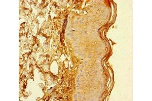 Immunohistochemistry of paraffin-embedded human skin tissue using ABIN7147268 at dilution of 1:100 (CYREN (AA 1-157) anticorps)