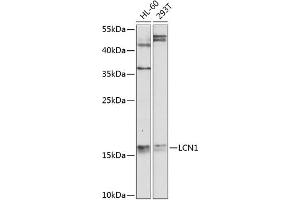 Western blot analysis of extracts of various cell lines, using LCN1 antibody  at 1:1000 dilution.