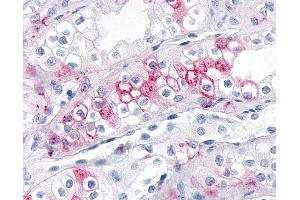 Anti-ADAMTS4 antibody IHC of human kidney. (ADAMTS4 anticorps  (Metalloprotease Domain))