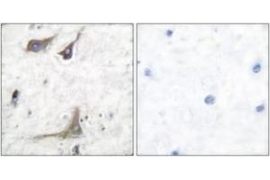 Immunohistochemistry analysis of paraffin-embedded human brain tissue, using Cox1 Antibody. (COX1 anticorps  (AA 550-599))