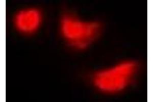 Immunofluorescent analysis of IMPDH2 staining in Hela cells. (IMPDH2 anticorps)