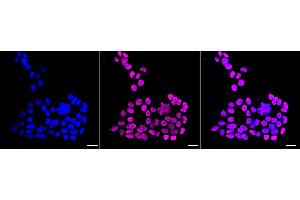 Immunocytochemical staining of HAP-1 cells with Histone H1. (Recombinant HIST1H1C anticorps)