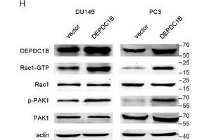 DEPDC1B regulates the Rho signaling pathway and binds to Rac1.