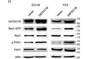 DEPDC1B regulates the Rho signaling pathway and binds to Rac1. (PAK1 anticorps  (AA 1-240))