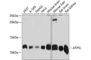 Western blot analysis of extracts of various cell lines using ATP5L Polyclonal Antibody at dilution of 1:3000.