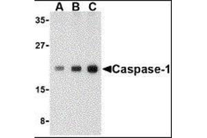 Western Blotting (WB) image for anti-Caspase 1 (CASP1) (C-Term) antibody (ABIN2477902) (Caspase 1 anticorps  (C-Term))