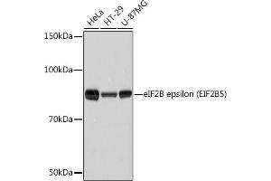 Western blot analysis of extracts of various cell lines, using eIF2B epsilon (EIF2B5) (EIF2B5) Rabbit mAb (ABIN7267038) at 1:1000 dilution. (EIF2B5 anticorps)