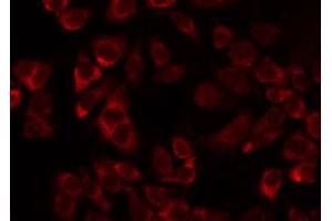ABIN6274727 staining Hela by IF/ICC. (MRPL11 anticorps  (Internal Region))
