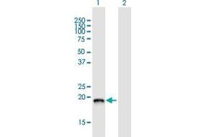 Western Blot analysis of DCTPP1 expression in transfected 293T cell line by DCTPP1 MaxPab polyclonal antibody. (DCTPP1 anticorps  (AA 1-170))