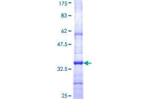 Image no. 1 for Isoprenylcysteine Carboxyl Methyltransferase (ICMT) (AA 86-154) protein (GST tag) (ABIN1307337)