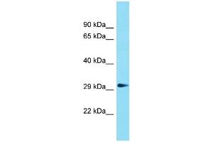 Western Blotting (WB) image for anti-Glycerophosphodiester Phosphodiesterase Domain Containing 1 (GDPD1) (N-Term) antibody (ABIN2791029) (GDPD1 anticorps  (N-Term))