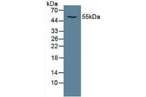 Figure. (CAMK2A anticorps  (AA 1-478))