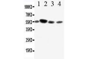 Anti-CD89 antibody, Western blotting Lane 1: A549 Cell Lysate Lane 2: U87 Cell Lysate Lane 3: RAJI Cell Lysate Lane 4: JURKAT Cell Lysate (FCAR anticorps  (AA 84-101))