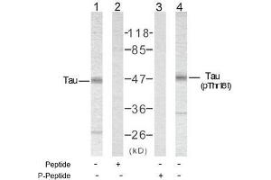 Image no. 2 for anti-Microtubule-Associated Protein tau (MAPT) (pThr181) antibody (ABIN196801) (MAPT anticorps  (pThr181))