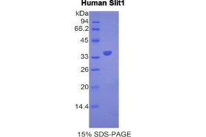 SDS-PAGE analysis of Human Slit Homolog 1 Protein. (SLIT1 Protéine)