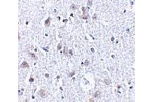 Immunohistochemistry of BRSK1 in human brain tissue with BRSK1 antibody at 2.