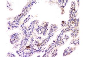 Flow cytometry testing of human SiHa cells with Amyloid beta antibody at 1ug/10^6 cells (blocked with goat sera) (APP anticorps  (C-Term))