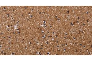 Immunohistochemistry of paraffin-embedded Human brain tissue using CLDND1 Polyclonal Antibody at dilution 1:40 (CLDND1 anticorps)
