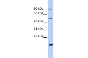 WB Suggested Anti-ZNF645 Antibody Titration:  0.