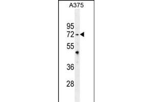 TRIM56 antibody  (C-Term)