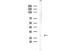 anti-Sodium Channel Modifier 1 (SCNM1) antibody