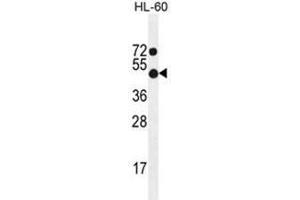 ADA Antibody (C-term) western blot analysis in HL-60 cell line lysates (35 µg/lane). (ADA anticorps  (C-Term))