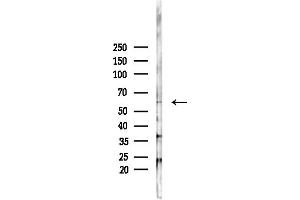 Western blot analysis of lysates from PC12 cells(heat-shock,45 min treatment), using Phospho-AMPK alpha (Thr172) Antibody at 1/1000 dilution.