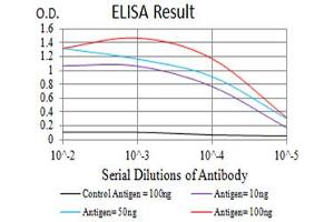 Black line: Control Antigen (100 ng),Purple line: Antigen (10 ng), Blue line: Antigen (50 ng), Red line:Antigen (100 ng)
