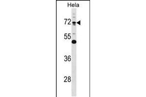 Western blot analysis in Hela cell line lysates (35ug/lane). (Epsin 1 anticorps  (AA 203-232))