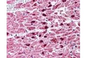 Immunohistochemistry (IHC) image for anti-Peroxisome Proliferator-Activated Receptor gamma (PPARG) (C-Term) antibody (ABIN2470320)