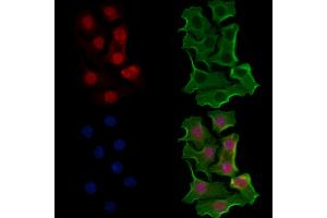 ABIN6257683 and ABIN6274587 staining Hela cells by IF/ICC.