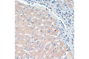 Immunohistochemistry of paraffin-embedded human liver using DBH antibody (ABIN6130337, ABIN6139418, ABIN6139419 and ABIN6218164) at dilution of 1:200 (40x lens). (DBH anticorps  (AA 388-617))