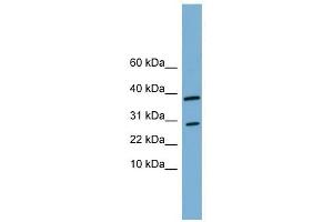 VNN3 antibody used at 1 ug/ml to detect target protein. (VNN3 anticorps  (N-Term))