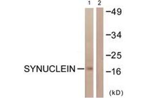 Western blot analysis of extracts from HuvEc cells, using Synuclein (Ab-129) Antibody. (Synuclein anticorps  (AA 91-140))