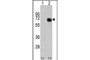 Western blot analysis of CKK2 (arrow) using rabbit polyclonal CKK2 Antibody (C-term) (ABIN1882069 and ABIN2841278). (CAMKK2 anticorps  (C-Term))
