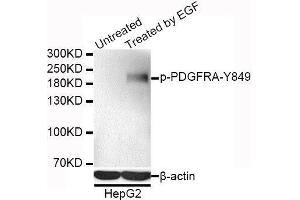 Western blot analysis of extracts of HepG2 cells, using Phospho-PDGFRA-Y849 antibody. (PDGFRA anticorps  (pTyr849))