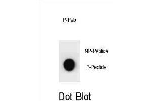 Dot blot analysis of CCNB2 Antibody (Phospho ) Phospho-specific Pab (ABIN1881158 and ABIN2839950) on nitrocellulose membrane. (Cyclin B2 anticorps  (pSer392))