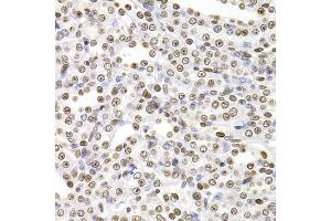 Immunohistochemistry of paraffin-embedded rat kidney using SOX5 antibody (ABIN5974201) at dilution of 1/100 (40x lens). (SOX5 anticorps)