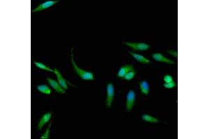 Immunofluorescence staining of Hela cells with ABIN7154629 at 1:133, counter-stained with DAPI. (K-RAS anticorps  (AA 2-168))