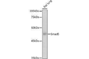 Western blot analysis of extracts of Rat lung, using Smad5 antibody (ABIN1682808, ABIN5663732, ABIN5663734 and ABIN6213914) at 1:500 dilution. (SMAD5 anticorps  (AA 140-240))