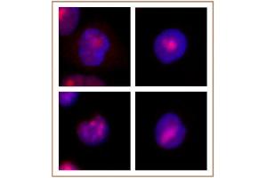WRN antibody (mAb) tested by Immunofluorescence.